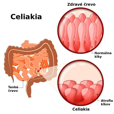 Schematické znázornenie 4-komorového žalúdka prežúvavca