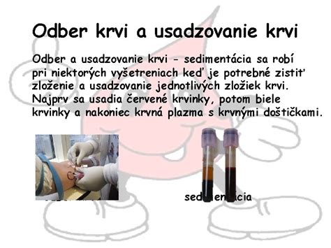 lekár robí odber krvi dieťaťu