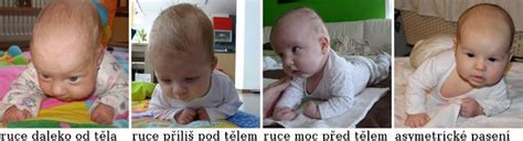 Dieťa v 3. mesiaci pri pasení koníkov