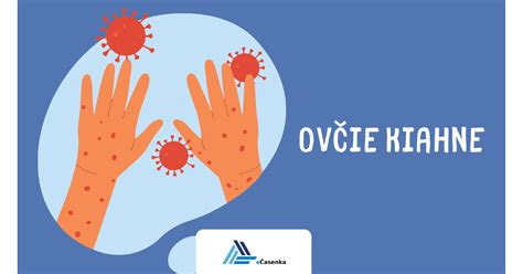 Priebeh ovčích kiahní na koži