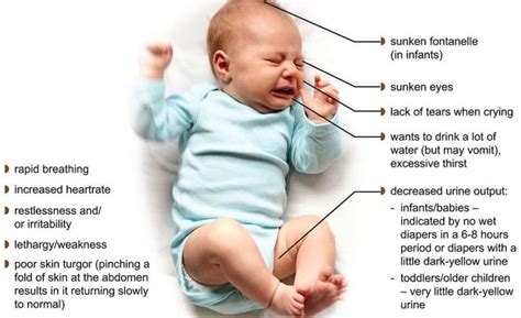 Symptoms of dehydration in children
