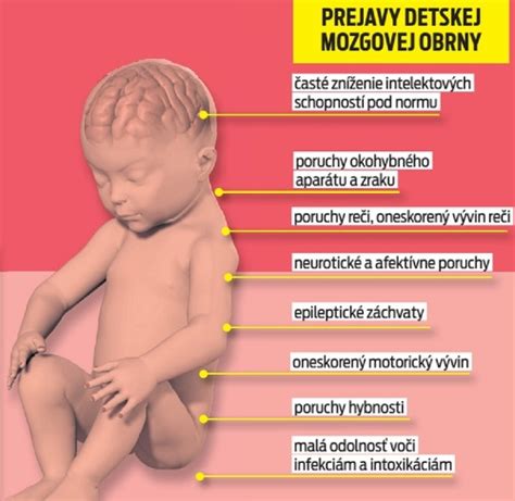 Prehľad rizikových faktorov detskej mozgovej obrny