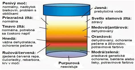 Infografika: Čo nám hovorí farba moču dieťaťa