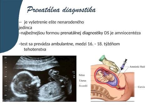 Schéma prenatálnej diagnostiky a genetického skríningu