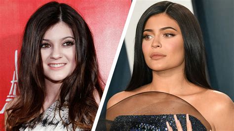 Kylie Jenner post-pôrodná premena