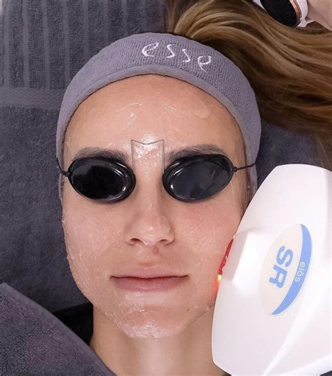 Princíp selektívnej fototermolýzy