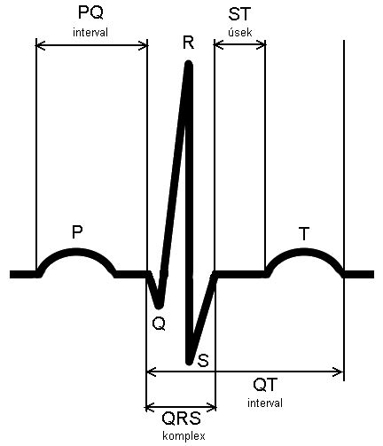 EKG krivka