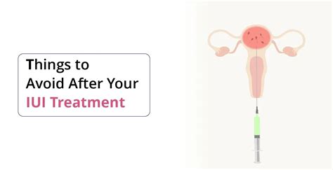 Zákrok intrauterinnej inseminácie (IUI)