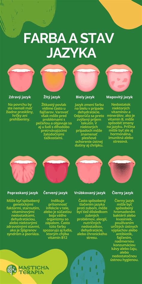 názorná ukážka tvorby baktérií na jazyku