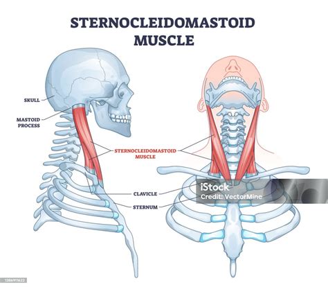 Diagram svalového tonusu