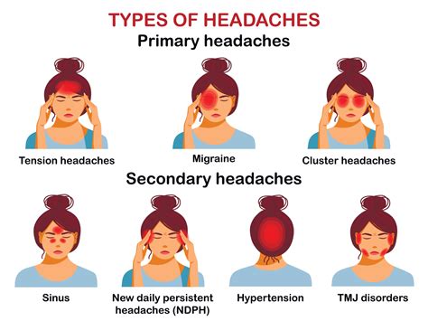 Types of headaches infographic