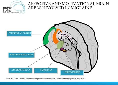 Brain regions affected by migraine