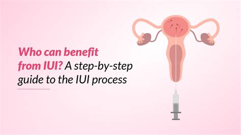 Ilustrácia intrauterinnej inseminácie (IUI)