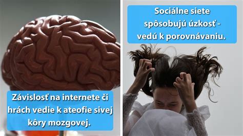 infografika zobrazujúca herné mechaniky a ich vplyv na mozog