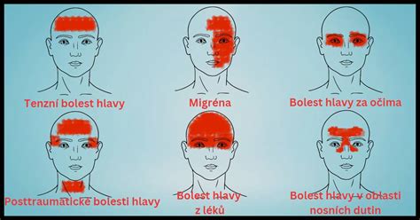 Schéma varovných príznakov úrazu hlavy
